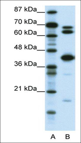 Anti-E2F2 antibody produced in rabbit