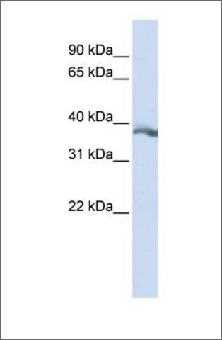 Anti-EDA (ab2) antibody produced in rabbit