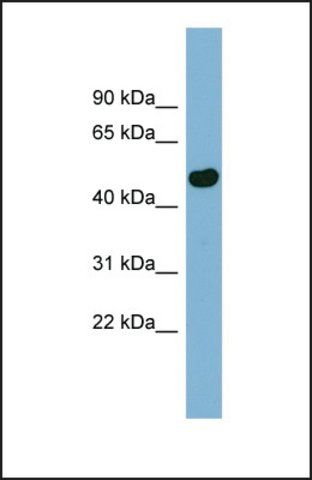 Anti-EFCAB4B, (N-terminal) antibody produced in rabbit