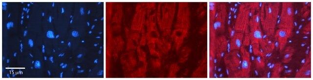 Anti-EFEMP1 antibody produced in rabbit