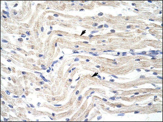 Anti-ELL (AB2) antibody produced in rabbit