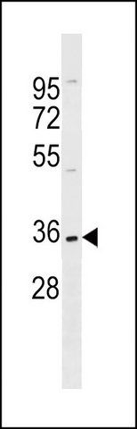 ANTI-ELOVL1 (N-TERM) antibody produced in rabbit