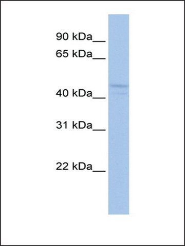 Anti-ELK4 antibody produced in rabbit