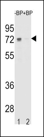 ANTI-ESR1 ISOFORM1 (C-TERM) antibody produced in rabbit