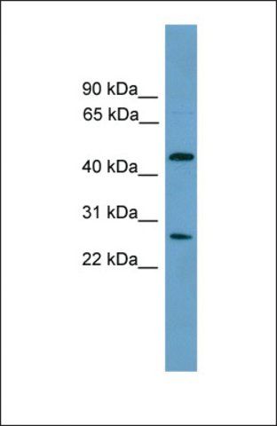 Anti-ELP4 antibody produced in rabbit