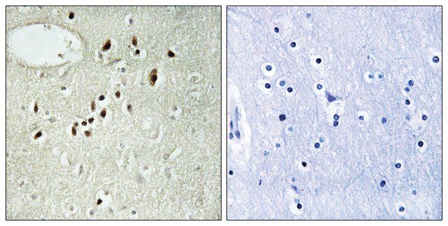 Anti-EMX2 antibody produced in rabbit