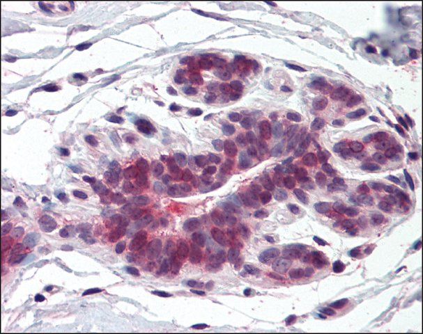 Anti-ELOVL5 antibody produced in rabbit