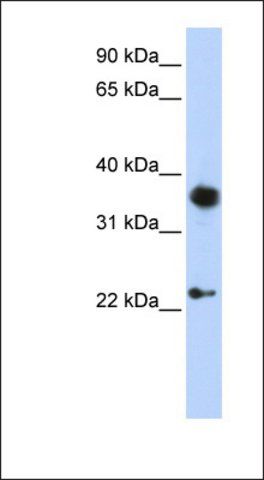 Anti-EN1 antibody produced in rabbit