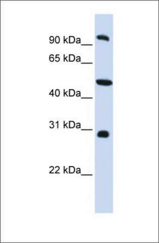 Anti-EML1 antibody produced in rabbit