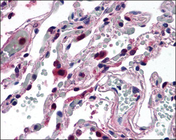 Anti-ELOVL5 antibody produced in rabbit