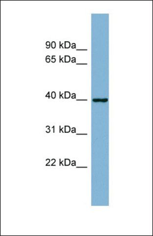 Anti-ELMOD2, (N-terminal) antibody produced in rabbit