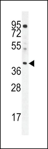 ANTI-ELMD2 (C-TERMINAL) antibody produced in rabbit