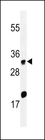 ANTI-ELOVL5(C-TERMINAL) antibody produced in rabbit