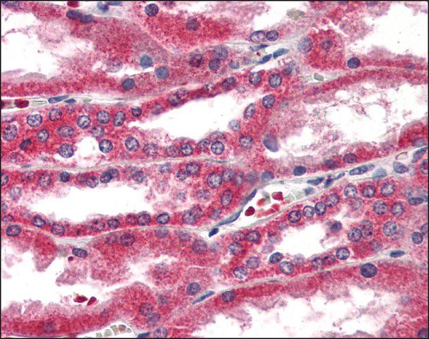 Anti-ERAP1 / ARTS1 antibody produced in rabbit