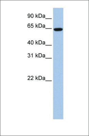 Anti-EPS8L1 antibody produced in rabbit