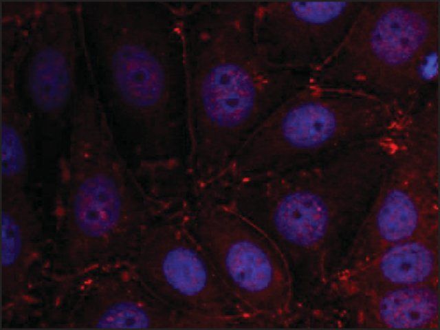 Anti-ERBB3 (Ab-1289) antibody produced in rabbit