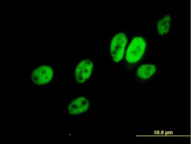 Anti-ERCC8 antibody produced in mouse