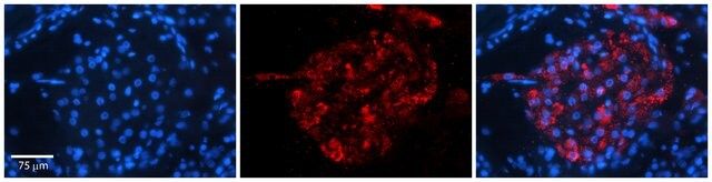 Anti-ERGIC3 antibody produced in rabbit