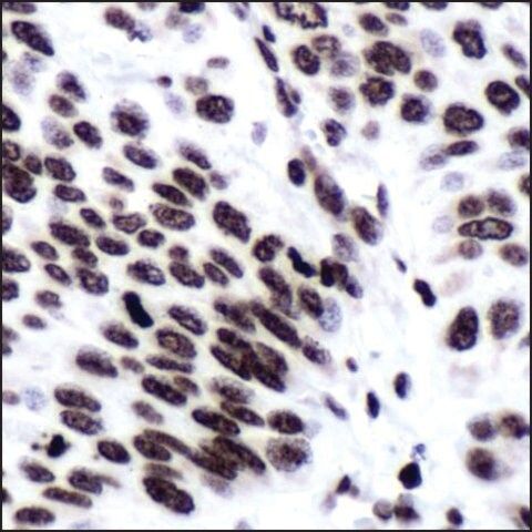 Anti-ERCC1 antibody, Rabbit monoclonal