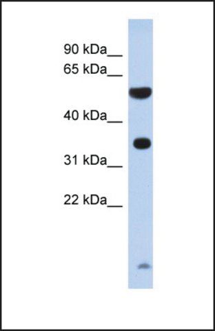 Anti-ESSPL, (N-terminal) antibody produced in rabbit