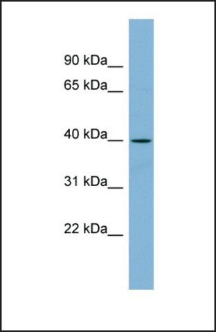 Anti-ETV3L antibody produced in rabbit