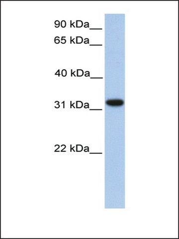 Anti-ETFA (AB2) antibody produced in rabbit