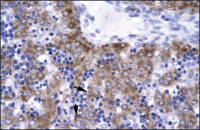 Anti-ERCC8 (ab1) antibody produced in rabbit