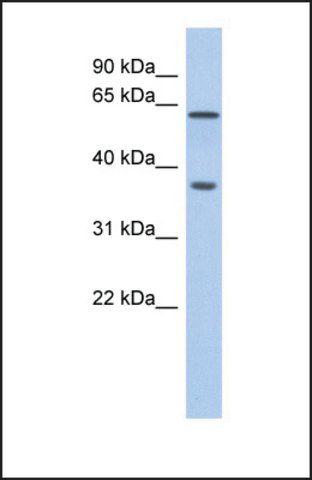 Anti-ERG, (N-terminal) antibody produced in rabbit