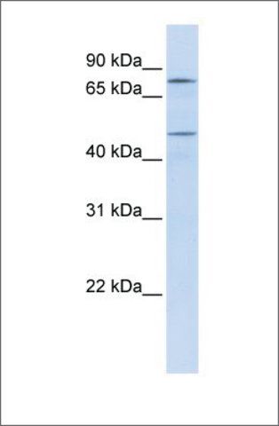 Anti-ERCC8 (ab1) antibody produced in rabbit