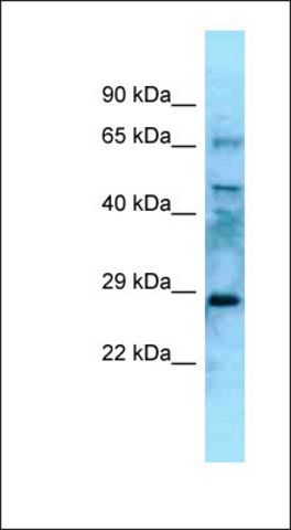 Anti-EYA4 antibody produced in rabbit