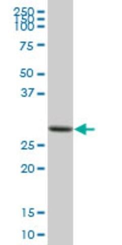 Anti-ETFB antibody produced in mouse