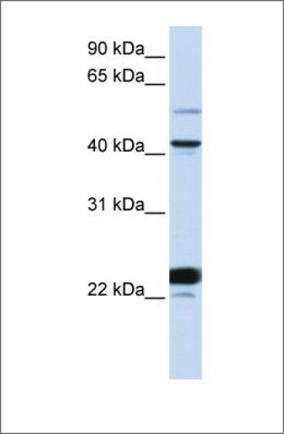 Anti-EVX1 antibody produced in rabbit