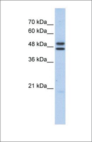 Anti-ERCC8 (ab3) antibody produced in rabbit