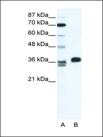 Anti-ESX1 (AB1) antibody produced in rabbit