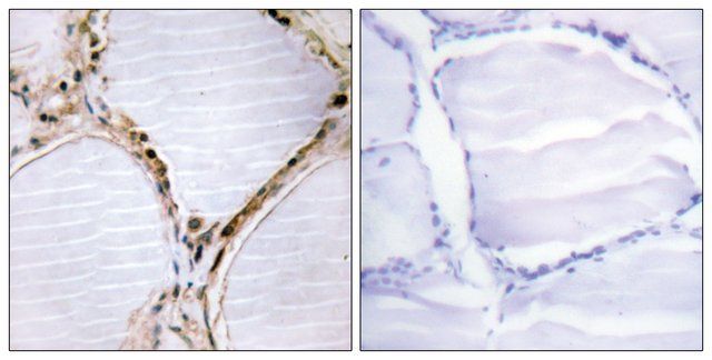 Anti-ETK, antibody produced in rabbit