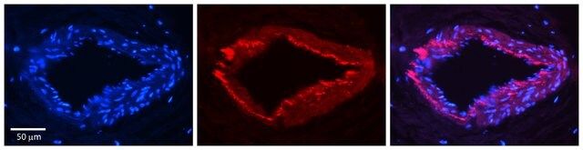 Anti-ESD, (N-terminal) antibody produced in rabbit