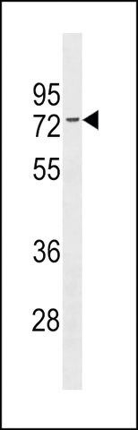 ANTI-ESR1 ISOFORM1 (N-TERM) antibody produced in rabbit