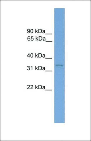 Anti-ETV2 antibody produced in rabbit