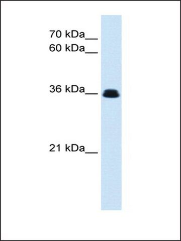 Anti-EVE antibody produced in rabbit