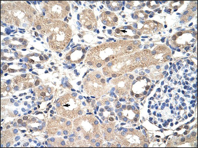 Anti-EXOSC7 antibody produced in rabbit