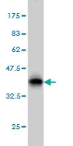 ANTI-ERN1 antibody produced in mouse