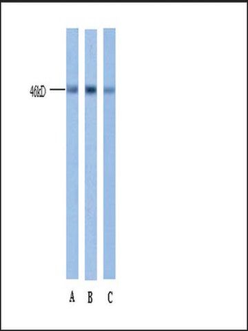 Anti-ERG antibody produced in rabbit