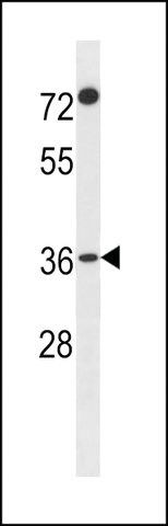 ANTI-F110A(N-TERMINAL) antibody produced in rabbit