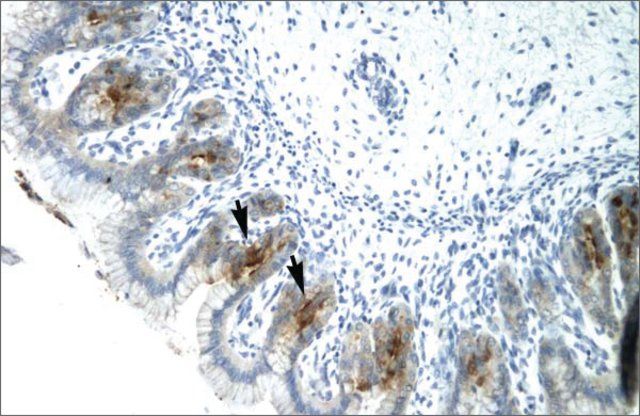 Anti-ETV6 antibody produced in rabbit