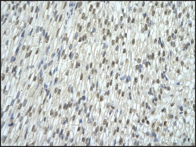 Anti-EXOSC7 antibody produced in rabbit