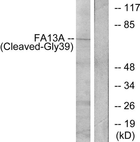 Anti-FA13A (Cleaved-Gly<sup>39</sup>), N-Terminal antibody produced in rabbit