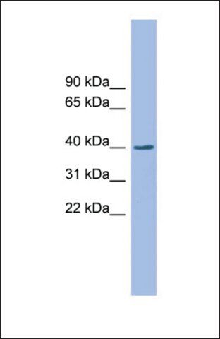 Anti-EXOD1, (N-terminal) antibody produced in rabbit