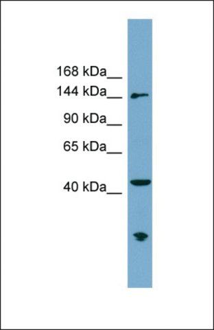 Anti-ERCC6L, (N-terminal) antibody produced in rabbit