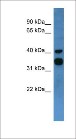 Anti-F2RL2 antibody produced in rabbit