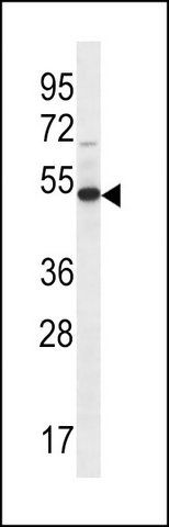 ANTI-FA8A1 (N-TERM) antibody produced in rabbit